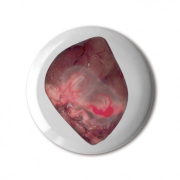 Gift Box: 4 button badges (Reserved)